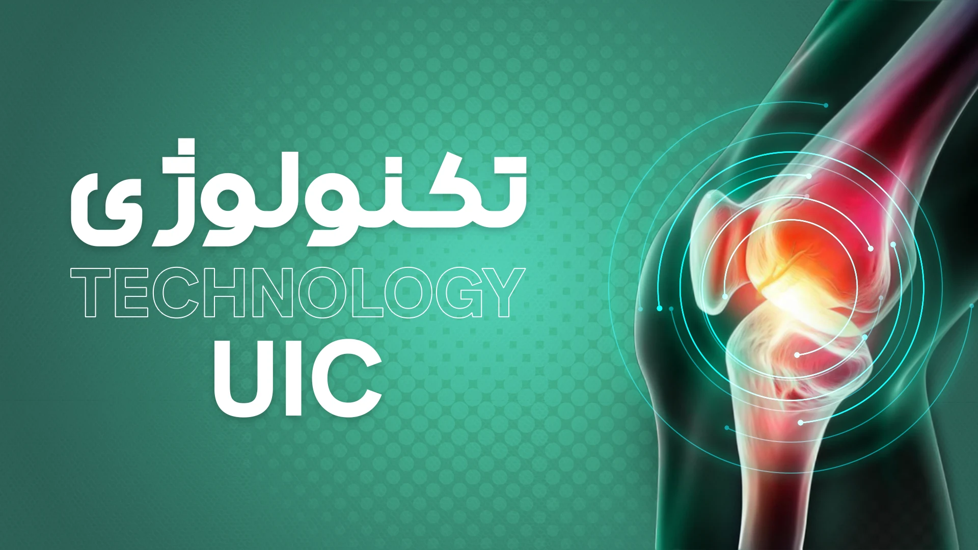 تکنولوژی زانوبند زاپیامکس