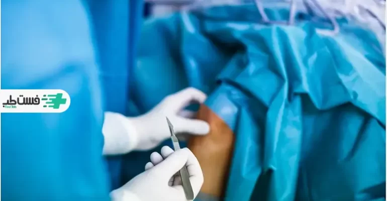 جراحی زانو روشی درماین برای آسیب های شدید|فست طب