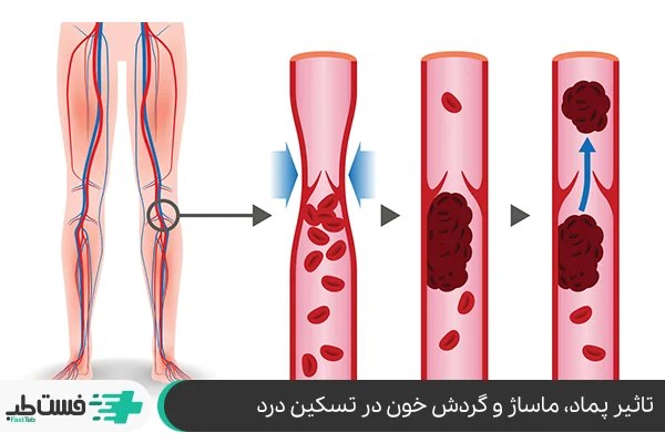 پماد ضد درد قوی خارجی یا برندهای ایرانی همراه با ماساژ و گردش خون|فست طب
