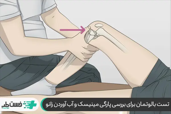 مراحل تست بالتمان برای ارزیابی آسیب زانو|فست طب