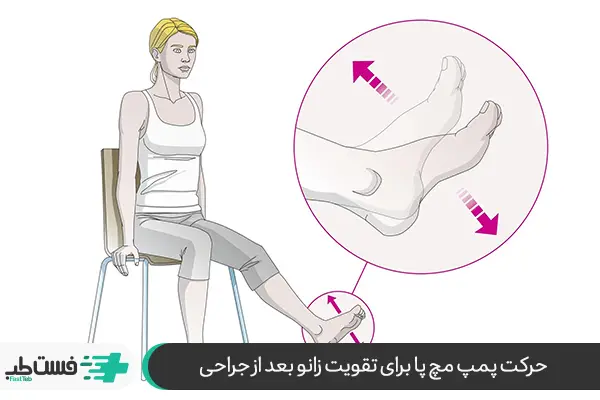 پمپ مچ پا یکی از ورزش مناسب بعد تعویض مفصل زانو|فست طب