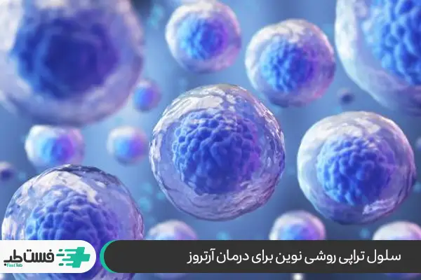 سلول‌های بنیادی داروی جدید آرتروز زانو|فست طب