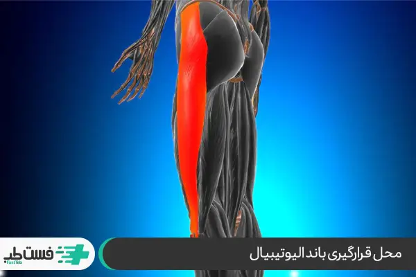 اناتومی پاها و نشان دادن باند ایلیو تیبیال |فست طب