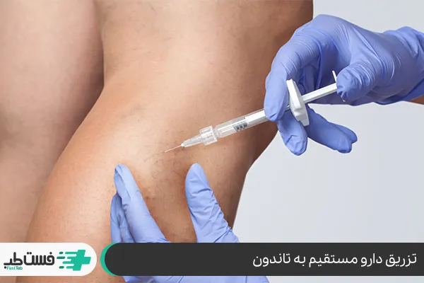 تزریق دارو برای کاهش التهاب تاندون همسترینگ|فست طب