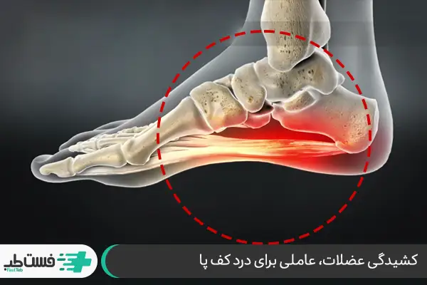 مهم‌ترین علل درد قسمت بالایی کف پا|فست طب