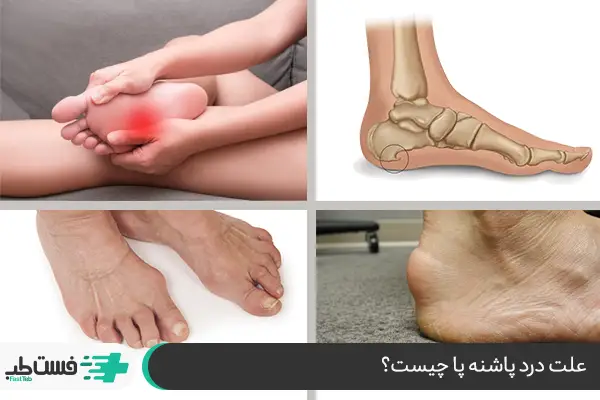 علت درد پاشنه پا چیست؟ |فست طب