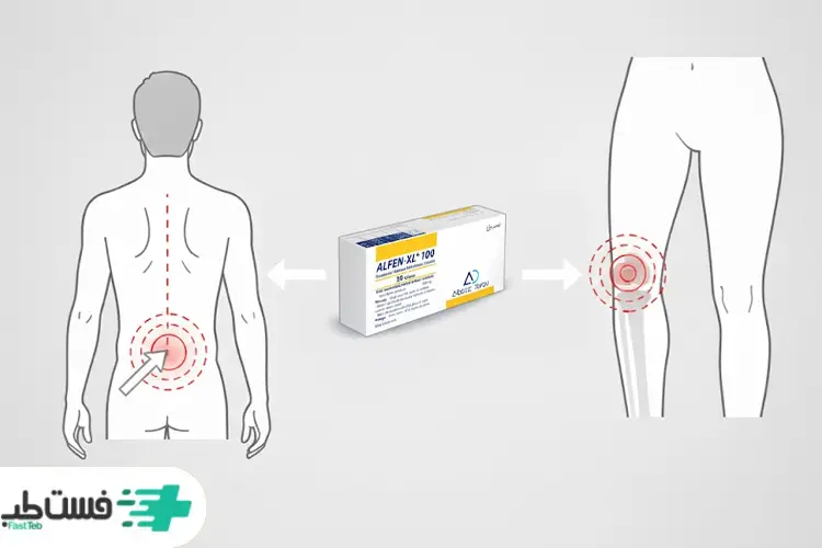 عملکرد قرص الفن ایکس ال 100 برای زانو و کمر