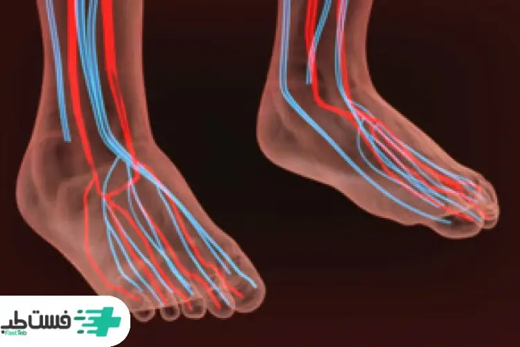 سردی پاها از زانو به پایین به علت ضعف گردش خون