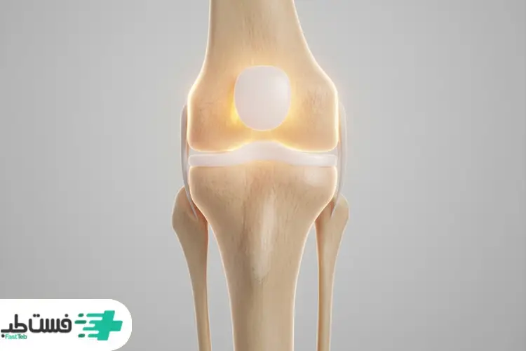 بهترین مکمل برای ساییدگی زانو