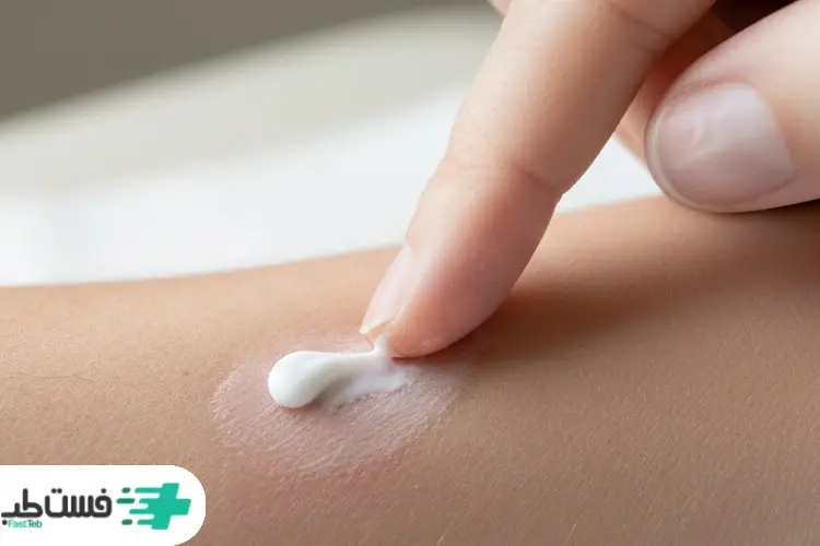 کاهش تورم و التهاب با پماد هیدروکورتیزون